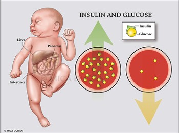  Infant Insulin and Glucose 