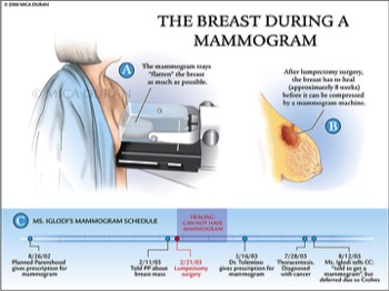  Breast During a Mammogram 