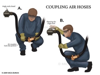  Transportation Injury - Train Coupling 